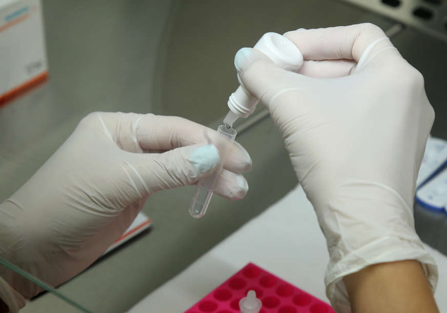 TAJNA JE U DNK Jednostavan test krvi otkriva 50 asimptomatskih vrsta raka