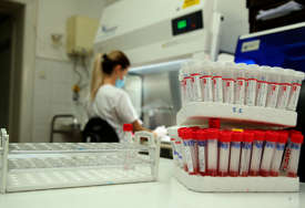 VAŽNO OTKRIĆE Proteini u krvi mogu upozoriti na kancer 7 godina prije dijagnoze