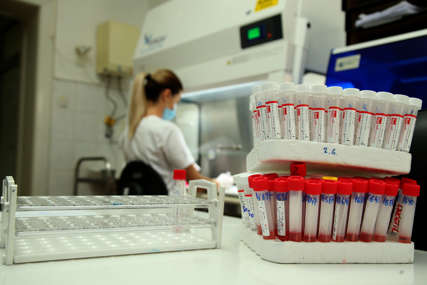 SVE ZAPISANO U GENIMA Naučnici sa beogradskog Medicinskog fakulteta otkrili kako DNK utiče na koronu