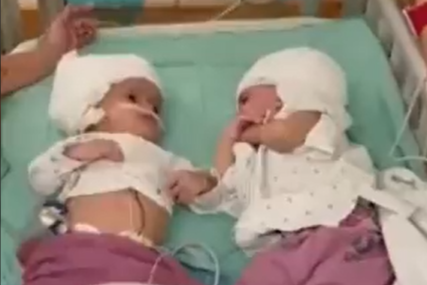 Vidjele se prvi put u životu: Uspješno razdvojene sijamske bliznakinje koje su rođene spojenih glava (FOTO, VIDEO)