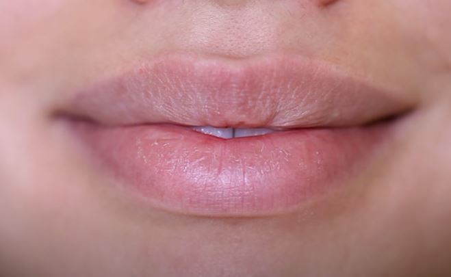 Problem suvih usana: Ovo su najčešći uzroci