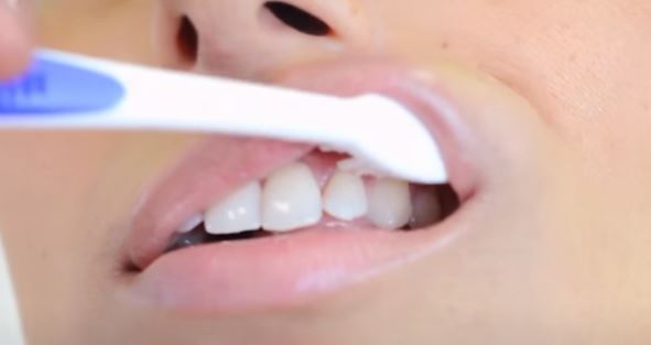 STOMATOLOZI ODGOVORILI Treba li prati zube prije ili poslije šoljice kafe?