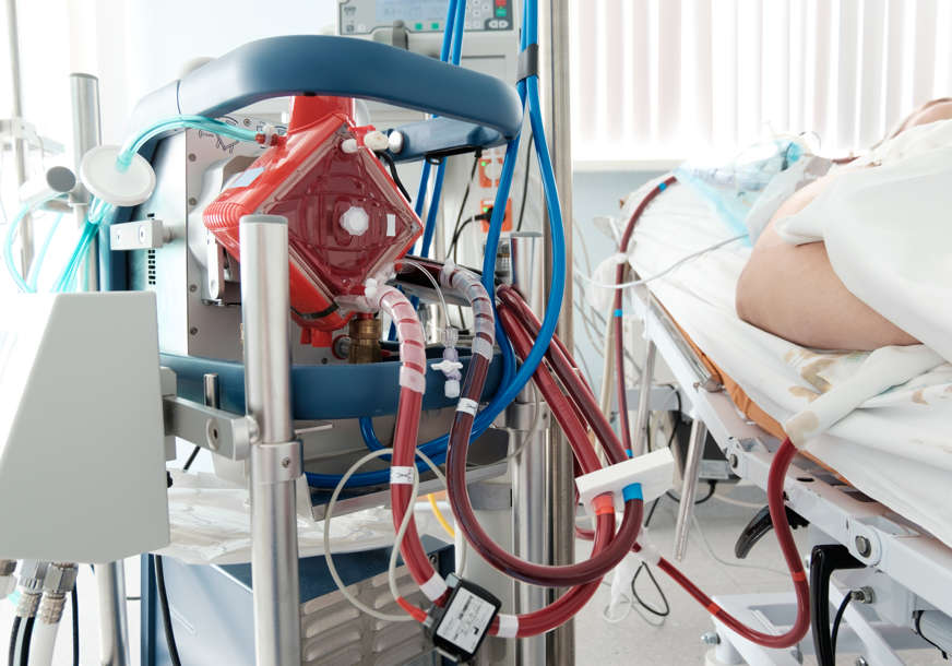 Samo 50 odsto pacijenata PREŽIVI OVAJ APARAT: Imaju bijela pluća, ne pomaže im ni respirator