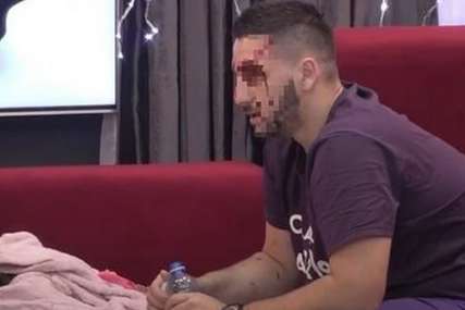 Krv mu se slivala niz lice: Miljana Kulić POSJEKLA GLAVU Zoli dok je spavao (FOTO)