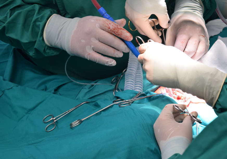 Prva transplantacija materice u Britaniji: Žena donirala organ sestri kako bi se ostvarila kao majka