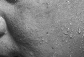 Njušili znoj zbog istraživanja: Šveđani dokazali da je udisanje mirisa drugih ljudi korisno