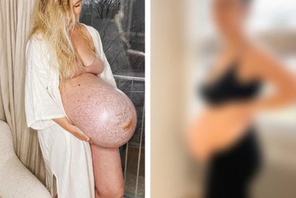 Ljudi u čudi zbog stomaka ove mame: Evo kako je izgleda nekoliko dana nakon porođaja (FOTO)