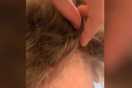 Snimak šokirao mnoge "Doveli su djevojčicu na šišanje, kad sam joj pogledala kosu, ODMAH SAM ZVALA SOCIJALNU SLUŽBU" (VIDEO)
