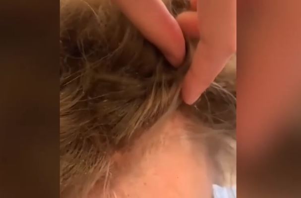 Snimak šokirao mnoge "Doveli su djevojčicu na šišanje, kad sam joj pogledala kosu, ODMAH SAM ZVALA SOCIJALNU SLUŽBU" (VIDEO)