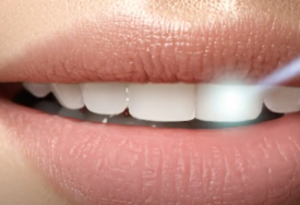 Problem se liječi u 3 koraka: Zub vas BOLI I ŠTRECA NA HLADNO, čak i kad udahnete ledeni vazduh