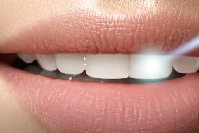 Smanjite njihov unos: Pet namirnica koje mogu više od ostalih da naštete zubima