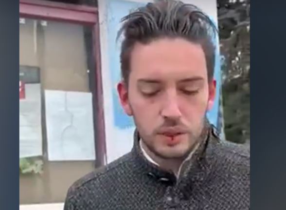 RIK POTVRDIO Napadnut lider Pokreta slobodnih građana Pavle Grbović, ima povrede na glavi (VIDEO)