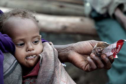 Većina smrtnih slučajeva ostane neevidentirana: U Etiopiji oko 1.900 djece  UMRLO OD GLADI
