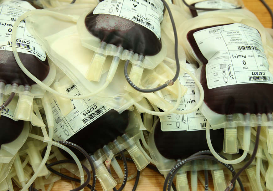 "Ljeti su najpotrebniji dobrovoljni davaoci krvi" Do sada u Srpskoj PRIKUPLJENO 5.500 DOZA KRVI