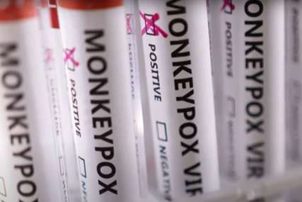 "Možemo da eliminišemo majmunske boginje u Evropi" Svjetska zdravstvena organizacija o suzbijanju zaraze