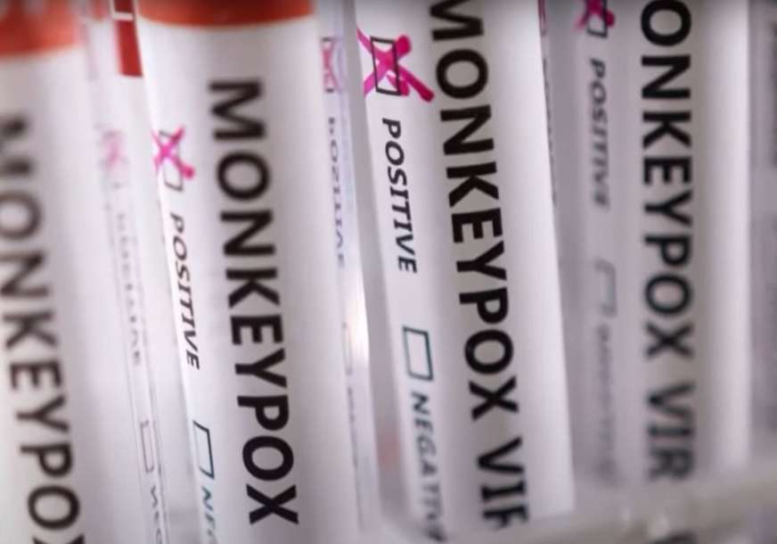 "Možemo da eliminišemo majmunske boginje u Evropi" Svjetska zdravstvena organizacija o suzbijanju zaraze