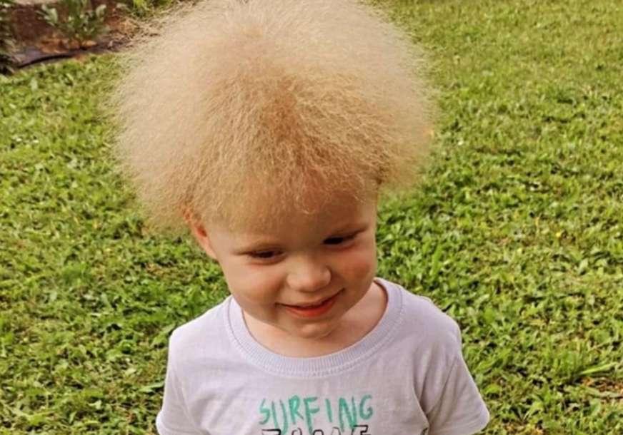 Ime je dobio prije rođenja i ono ga je odredilo: Maleni Lav je jedno od 100 djece na svijetu sa ovakvom kosom (FOTO)