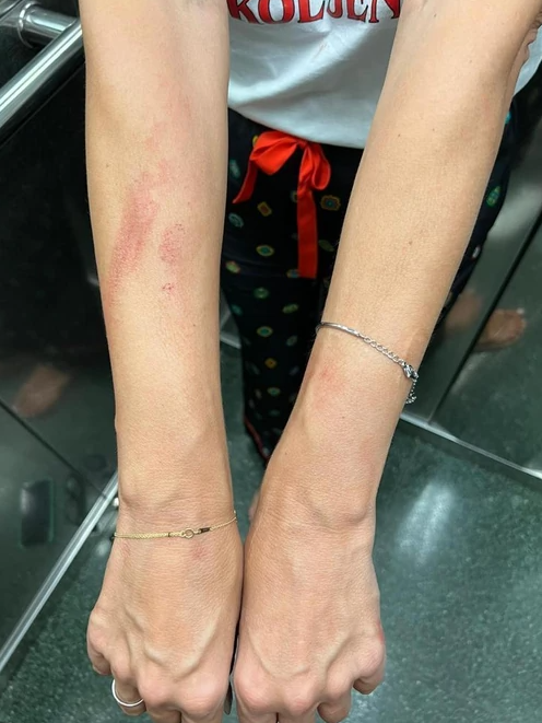 FOTO: SEVERINA/ PRIVATNA ARHIVA