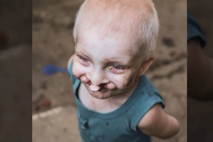 Uskoro prva operacija malog Pavla: Dječak (3) koji zbog rascjepa usana i nepca ne može da govori i jede primljen u bolnicu