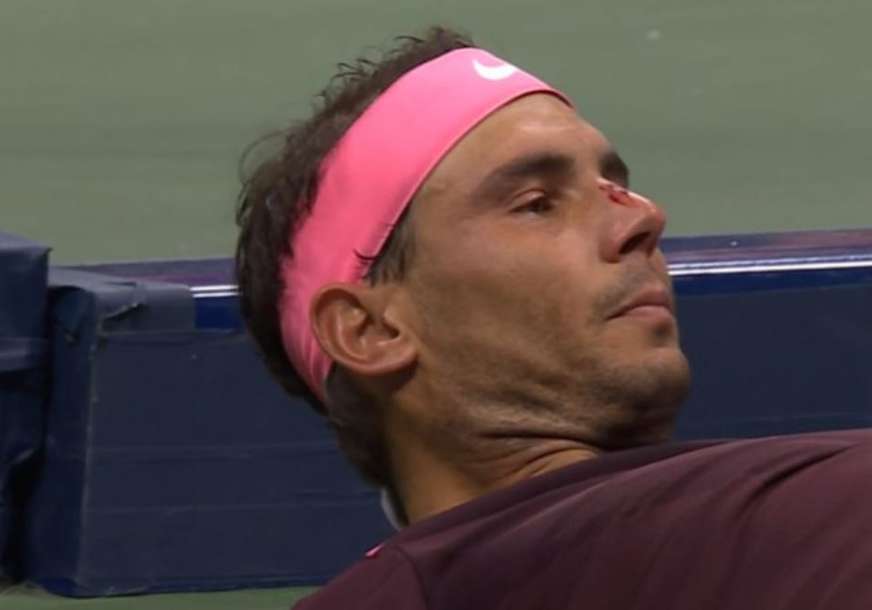 Prošao u treće kolo: Nadal s krvavim nosom slomio Fonjinija (VIDEO, FOTO)