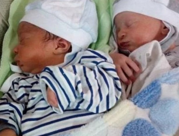 I majka i ljekari poslije porođaja ostali u čudu: Jednojajčani su blizanci, ali nimalo ne liče (VIDEO, FOTO)