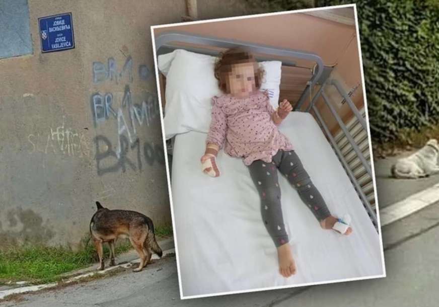 Djevojčica ostala bez prsta, ko je kriv: Sve više vlasnika životinje izbacuje na ulicu, a onda one postaju prijetnja