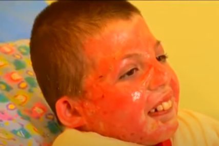 Izdržao ono što mnogi ne bi: Dječak imao MALE ŠANSE DA PREŽIVI nakon vatrene stihije, a danas se vraća životu (VIDEO)