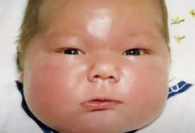 Bio je proglašen za najveću bebu ikada: Evo kako sada izgleda čovjek rođen sa više od 7 kilograma (VIDEO)