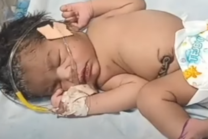 Snimak obilazi svijet: Djevojčica rođena sa 4 noge (VIDEO)