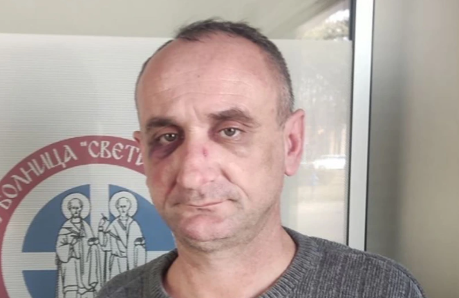 "Zadao mi je 6 udaraca, nisam pružao otpor" Direktor "Vodovoda" pretukao Branu Grujičića