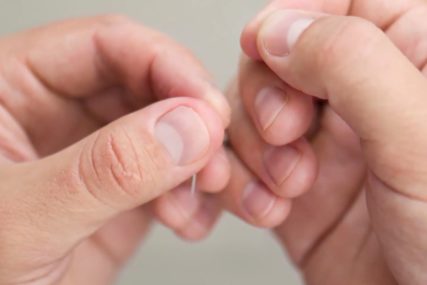 Promjene ne smijete zanemariti: Boja nokta otkriva određene zdravstvene probleme