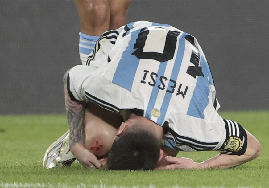 Lionel Mesi povrijeđen na travi