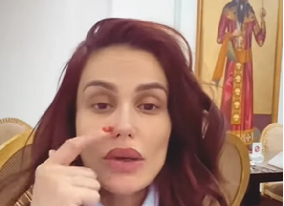  Indira Aradinović pokazuje sinuse