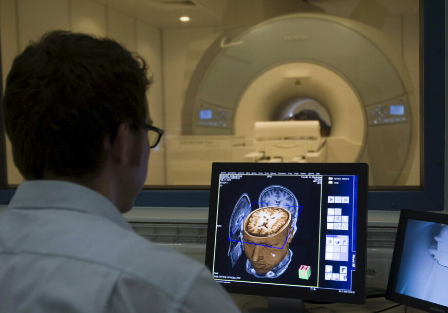 Magnetna rezonanca mozga