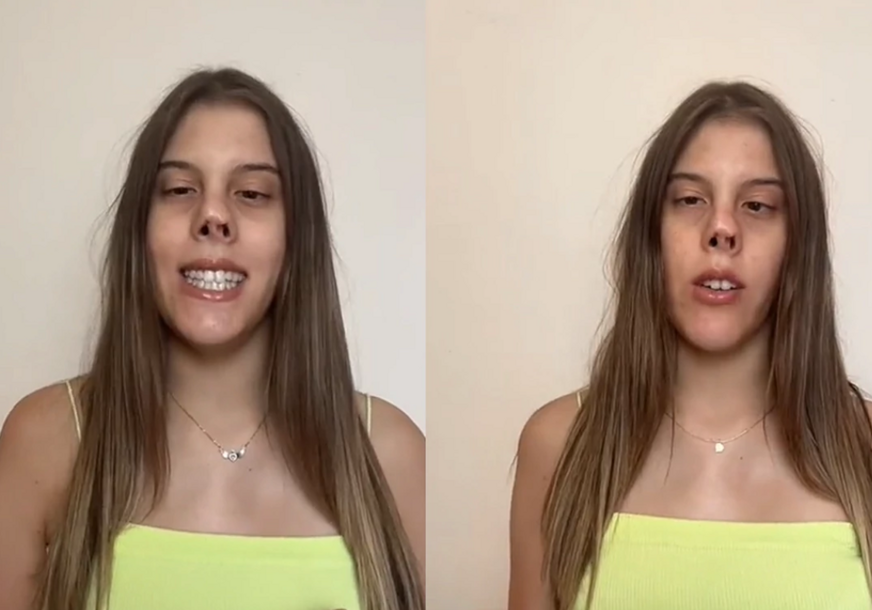 "Hejtujte koliko hoćete" Anastasiju (20) zbog fizičkog izgleda mnogi ismijavaju, ali nju takvi komentari ne dotiču (VIDEO)