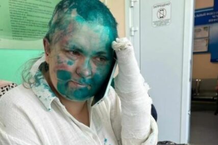 Ruska novinarka prebačena u bolnicu: Pretučena u Čečeniji, napadači joj obrijali glavu i polili je zelenom bojom