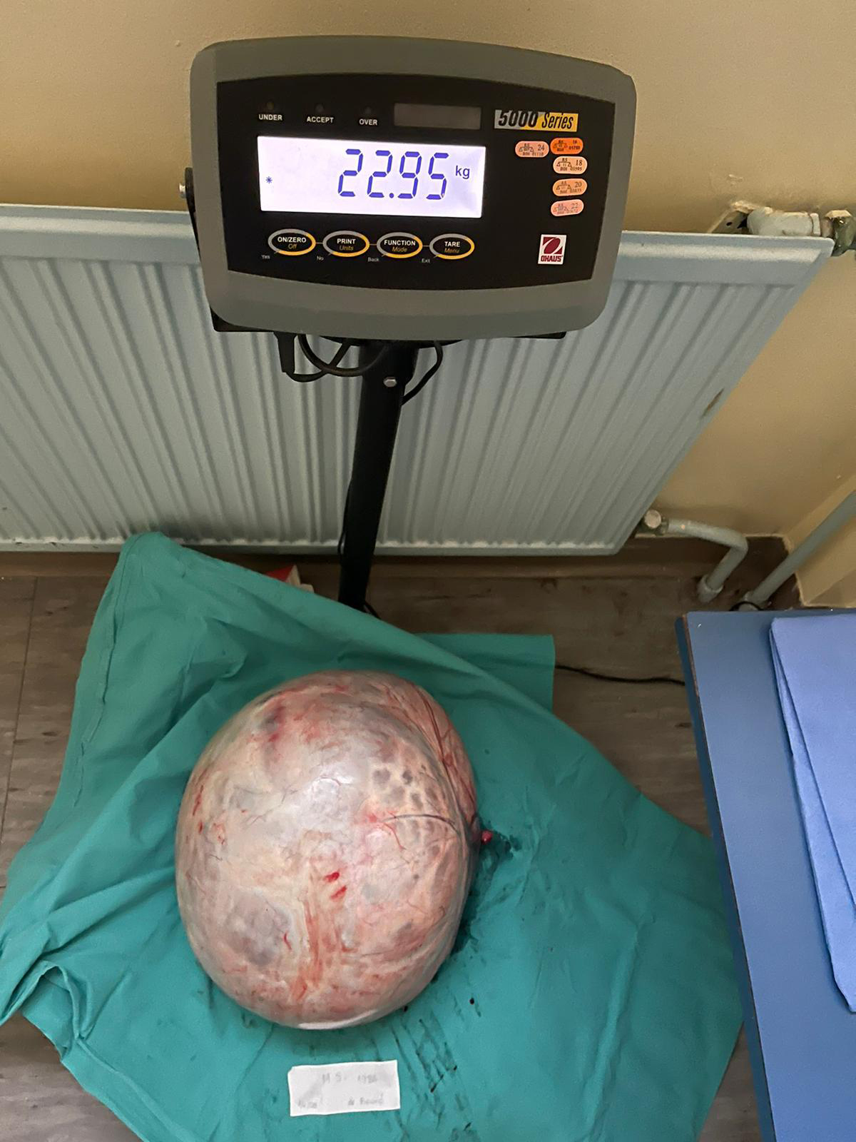 TUMOR