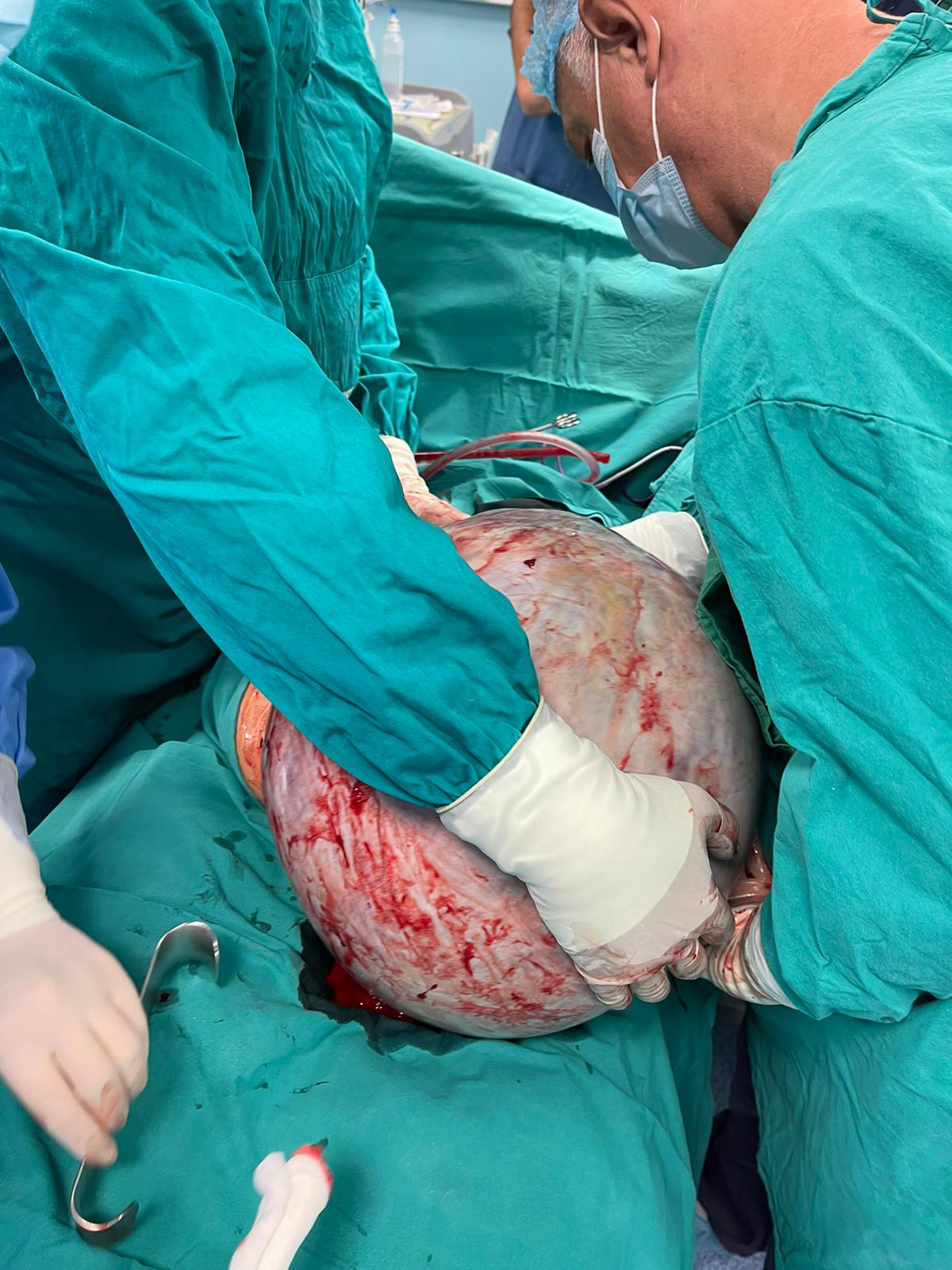 TUMOR