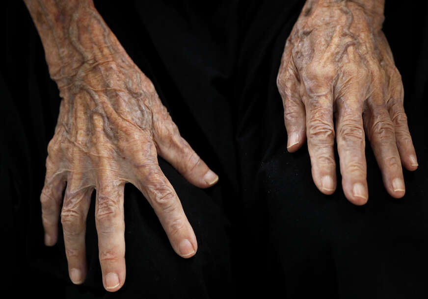 ruke starije osobe