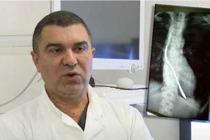 (VIDEO, FOTO) Hirurg iz Urgentnog pokazao bizarne rendgenske snimke "Ljudi gutaju viljuške, federe od kreveta, jednom smo U TIJELU NAŠLI DEZODORANS"