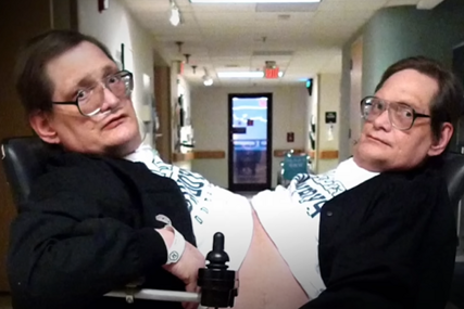(VIDEO) "Oni su jedno tijelo, ali dvije vrlo različite osobe" Roni i Doni su sijamski blizanci sa najdužim životnim vijekom