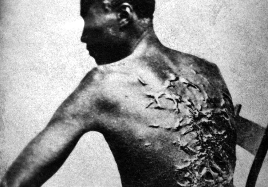 izbičevani rob 1863. godine