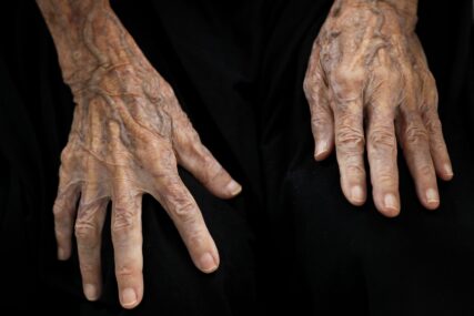 ruke starije osobe