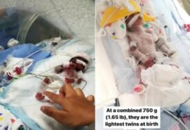 (VIDEO) Mogli su da stanu na dlan ruke svoje mame: Kako danas izgledaju najmanji blizanci ikad rođeni, uskoro pune dvije godine