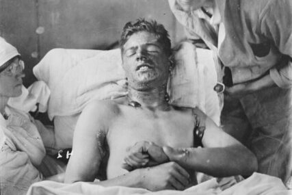 ranjenik u Prvom svjetskom ratu