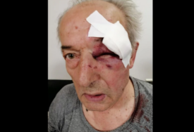 (FOTO) Novi detalji brutalnog napada na GENERALA: Uhapšen muškarac koji je napao Čađenovića (75)