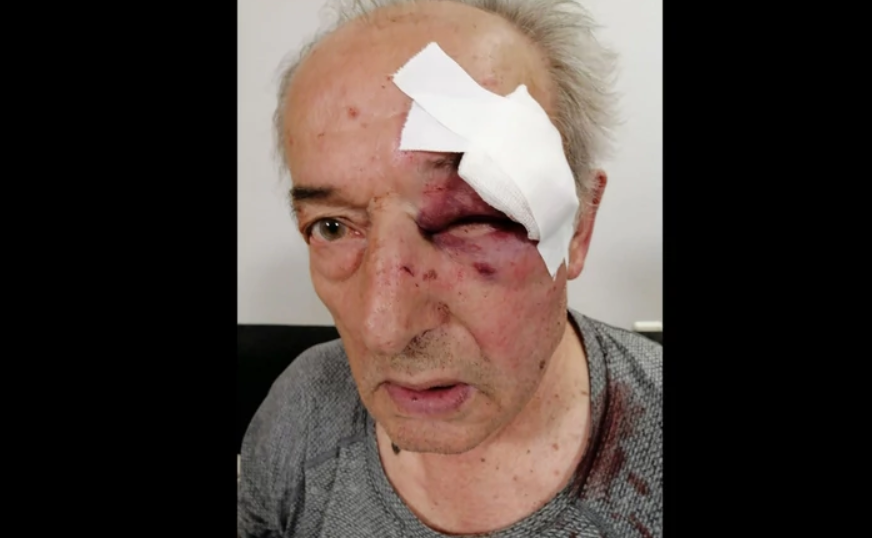 Saslušan muškarac koji je pretukao GENERALA U PENZIJI: krvnički su ga tukla 3 nasilnika, poznato kako se branio uhapšeni