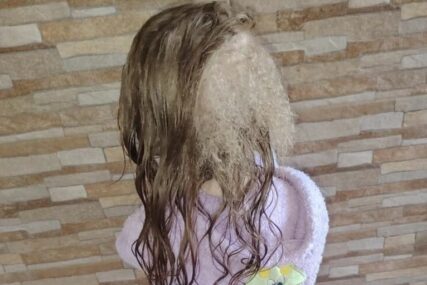 Djevojčici na glavi rastu 3 vrste kose