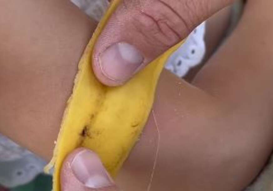 banana, ugriz od komarca