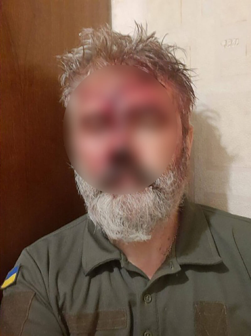 FOTO: ЦАПЛІЄНКО_UKRAINE FIGHTS/TELEGRAM / DRUSTVENE MREZE